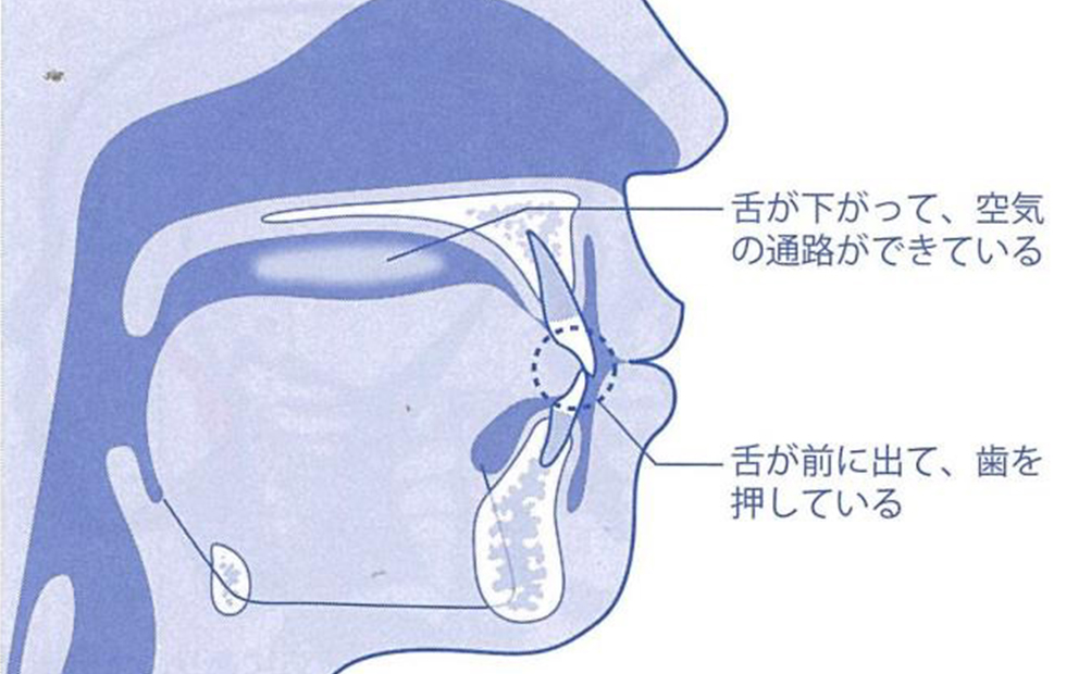 呼吸の仕方が舌の位置を決めます